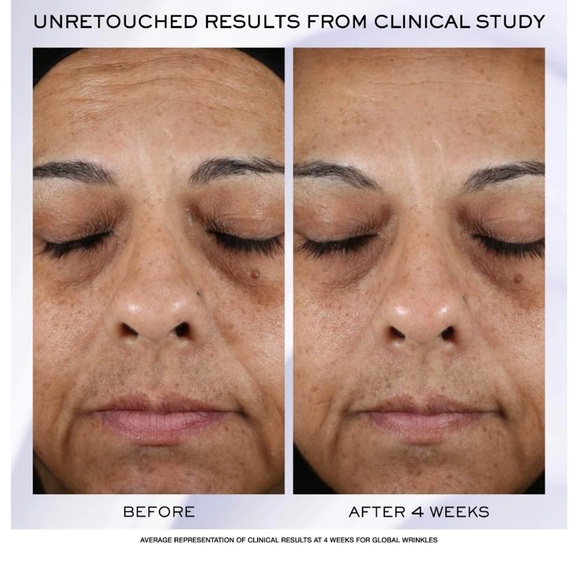 NEW TRAVEL SIZE LANCOME RENERGIE HPN 300 MOISTURIZER 15 ml - Picture 2 of 8